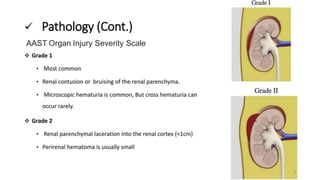 Renal Trauma | Diagnosis, Management and Followup | PPTX