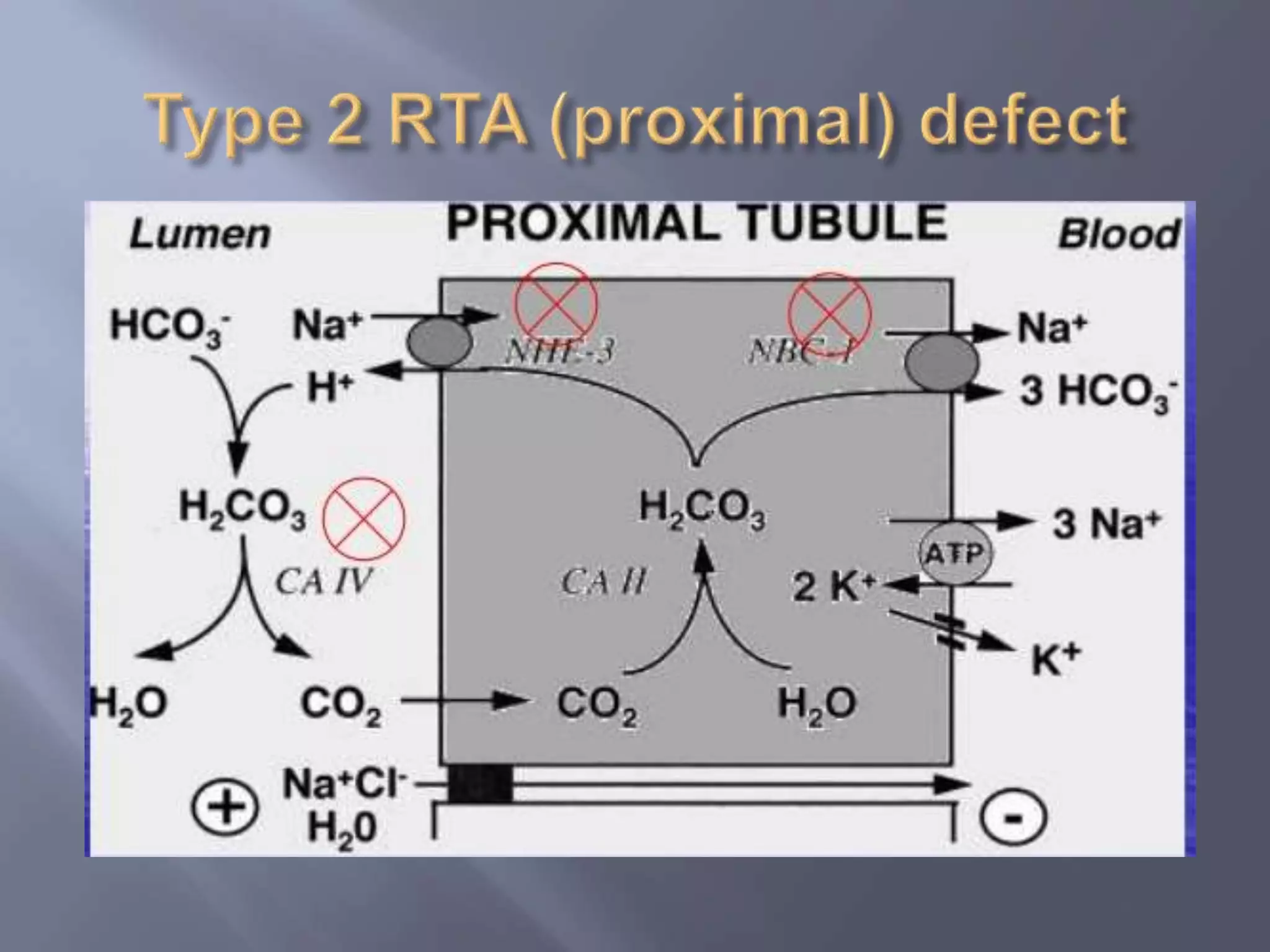 Renal tubular acidosis | PPTX