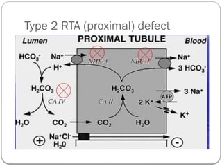 Renal tubular acidosis in pediatrics patient | PPTX