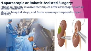 •Laparoscopic or Robotic-Assisted Surgery:
•These minimally invasive techniques offer advantages such as
smaller incisions.
shorter hospital stays, and faster recovery compared to open
surgery,
 