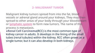 2- MALIGNANT TUMOR
Malignant kidney tumors spread from into the fat, blood
vessels or adrenal gland around your kidneys. They may then
spread to other areas of your body through your bloodstream
or lymphatic system to form new tumors. The name of this
process is metastasis.
●Renal Cell Carcinoma(RCC) is the most common type of
kidney cancer in adults. It develops in the lining of the small
tubes (renal tubules) within the kidney. RCC often grows as a
single tumor, but it can also develop in both kidneys.
 