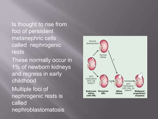 renaltumors upasana sahu Group 50.pptxism | PPTX