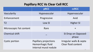 Renal Tumour Imaging | PPTX