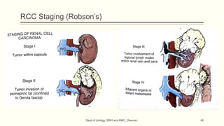 Robson Classification Rcc Staging Comprehensive Overview of Renal Tumours: Diagnosis, Classification, and ...