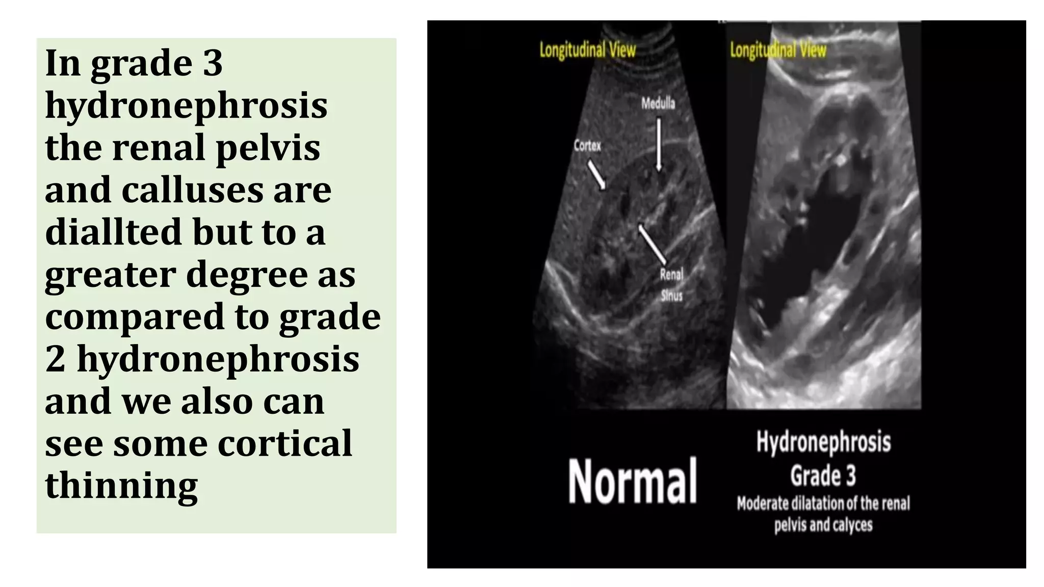 renal ultrasound.pptx