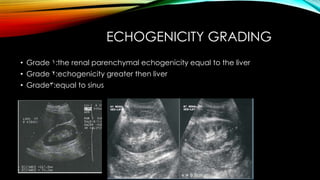 Renal pathology in Ultrasound.pdf