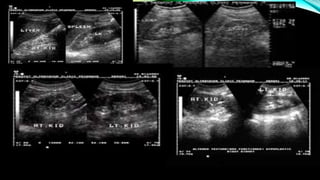 Renal pathology in Ultrasound.pdf