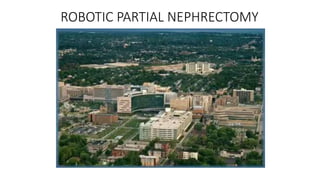 ROBOTIC PARTIAL NEPHRECTOMY
 