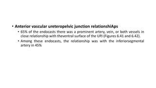 • Anterior vascular ureteropelvic junction relationshiAps
• 65% of the endocasts there was a prominent artery, vein, or both vessels in
close relationship with theventral surface of the UPJ (Figures 6.41 and 6.42).
• Among these endocasts, the relationship was with the inferiorsegmental
artery in 45%
 