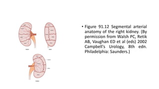 • Figure 91.12 Segmental arterial
anatomy of the right kidney. (By
permission from Walsh PC, Retik
AB, Vaughan ED et al (eds) 2002
Campbell's Urology, 8th edn.
Philadelphia: Saunders.)
 