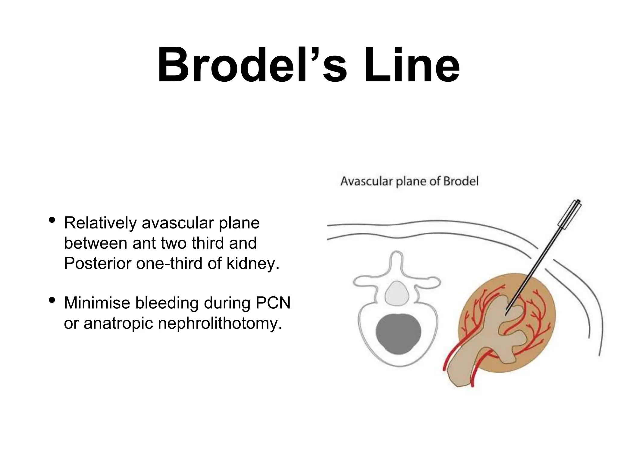 A practical guide to Renal Vascular Diseases.pptx