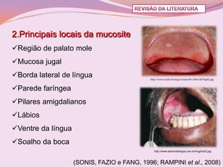 2.Principais locais da mucosite
Região de palato mole
Mucosa jugal
Borda lateral de língua                     http://www.scielo.br/img/revistas/rb/v38n2/a07fig02.jpg


Parede faríngea
Pilares amigdalianos
Lábios
Ventre da língua
Soalho da boca
                                                http://www.estomatologia.com.br/img/bc02.jpg



                    (SONIS, FAZIO e FANG, 1996; RAMPINI et al., 2008)
 