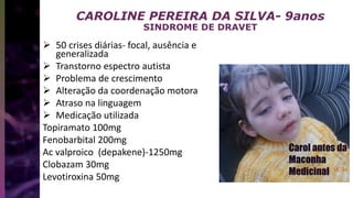CAROLINE PEREIRA DA SILVA- 9anos
SINDROME DE DRAVET
 50 crises diárias- focal, ausência e
generalizada
 Transtorno espectro autista
 Problema de crescimento
 Alteração da coordenação motora
 Atraso na linguagem
 Medicação utilizada
Topiramato 100mg
Fenobarbital 200mg
Ac valproico (depakene)-1250mg
Clobazam 30mg
Levotiroxina 50mg
 