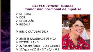 GIZELE THAME- 61anos
tumor não hormonal de hipófise
 ESTRESSE
 DOR
 DEPRESSÃO
 INSONIA
 INICIO OUTUBRO 2017
 2MESES QUALIDADE DE VIDA
 ESTAVEL 1 ANO
 22/janeiro/2018 – 1,2 x 0,8 x 0,8
 17/agosto/2018 - 0,7 x 0,4 x 0,8
 