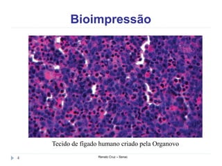 Bioimpressão
Renato Cruz – Senac4
Tecido de fígado humano criado pela Organovo
 