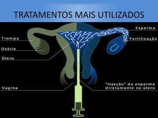 TRATAMENTOS MAIS UTILIZADOS
 