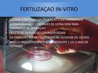 FERTILIZAÇAO IN-VITRO
• OCORRE A INDUÇAO DA OVULAÇAO COM HORMONIOS
• ACOMPANHAMENTO ATRAVES DE ULTRA-SOM PARA
CONTRLOLE DE OVULAÇAO
• COLETA DE OVULOS DO ESPERMATOZOIDE
• OS EMBRIOES SERAO COLOCADOS NO INTERIOR DO ULTERO
• APÓS O PROCEDIMENTO E RECOMENDADO 2 OU 3 DIAS DE
REPOUSO.
 