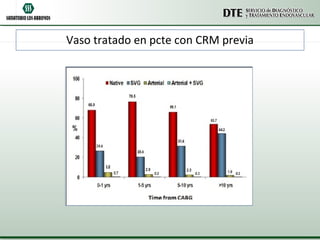 Vaso tratado en pcte con CRM previa
 