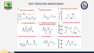 Ra Waveform Rhc Rengga_PPT GELOMBANG RHC dari FKUNAND.pptx
