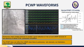 Normal Pcwp Rhc Rengga_PPT GELOMBANG RHC dari FKUNAND.pptx
