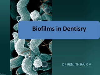 DR RENJITH RAJ C V
Biofilms in Dentisry
 