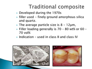  Developed during the 1970s
 filler used - finely ground amorphous silica
and quartz.
 The average particle size is 8 - 12µm,
 Filler loading generally is 70 – 80 wt% or 60 –
70 vol%
 Indication – used in class II and class IV
 