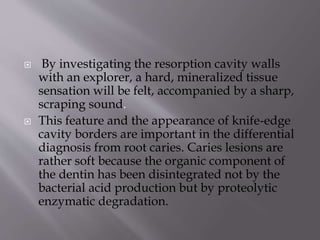  By investigating the resorption cavity walls
with an explorer, a hard, mineralized tissue
sensation will be felt, accompanied by a sharp,
scraping sound.
 This feature and the appearance of knife-edge
cavity borders are important in the differential
diagnosis from root caries. Caries lesions are
rather soft because the organic component of
the dentin has been disintegrated not by the
bacterial acid production but by proteolytic
enzymatic degradation.
 