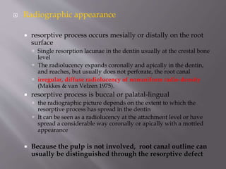  Radiographic appearance
 resorptive process occurs mesially or distally on the root
surface
 Single resorption lacunae in the dentin usually at the crestal bone
level
 The radiolucency expands coronally and apically in the dentin,
and reaches, but usually does not perforate, the root canal
 irregular, diffuse radiolucency of nonuniform radio-density
(Makkes & van Velzen 1975).
 resorptive process is buccal or palatal-lingual
 the radiographic picture depends on the extent to which the
resorptive process has spread in the dentin
 It can be seen as a radiolucency at the attachment level or have
spread a considerable way coronally or apically with a mottled
appearance
 Because the pulp is not involved, root canal outline can
usually be distinguished through the resorptive defect
 