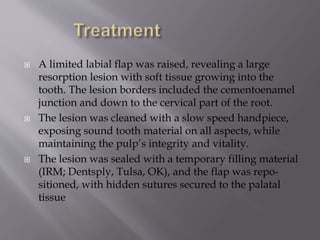  A limited labial flap was raised, revealing a large
resorption lesion with soft tissue growing into the
tooth. The lesion borders included the cementoenamel
junction and down to the cervical part of the root.
 The lesion was cleaned with a slow speed handpiece,
exposing sound tooth material on all aspects, while
maintaining the pulp’s integrity and vitality.
 The lesion was sealed with a temporary filling material
(IRM; Dentsply, Tulsa, OK), and the flap was repo-
sitioned, with hidden sutures secured to the palatal
tissue
 