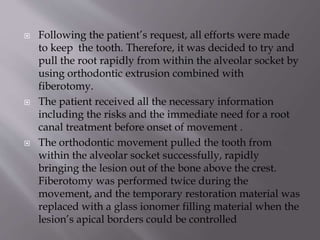  Following the patient’s request, all efforts were made
to keep the tooth. Therefore, it was decided to try and
pull the root rapidly from within the alveolar socket by
using orthodontic extrusion combined with
fiberotomy.
 The patient received all the necessary information
including the risks and the immediate need for a root
canal treatment before onset of movement .
 The orthodontic movement pulled the tooth from
within the alveolar socket successfully, rapidly
bringing the lesion out of the bone above the crest.
Fiberotomy was performed twice during the
movement, and the temporary restoration material was
replaced with a glass ionomer filling material when the
lesion’s apical borders could be controlled
 