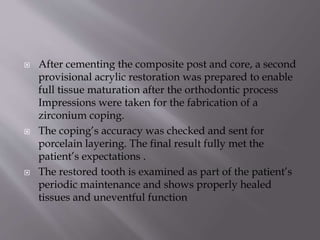  After cementing the composite post and core, a second
provisional acrylic restoration was prepared to enable
full tissue maturation after the orthodontic process
Impressions were taken for the fabrication of a
zirconium coping.
 The coping’s accuracy was checked and sent for
porcelain layering. The final result fully met the
patient’s expectations .
 The restored tooth is examined as part of the patient’s
periodic maintenance and shows properly healed
tissues and uneventful function
 