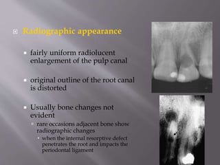  Radiographic appearance
 fairly uniform radiolucent
enlargement of the pulp canal
 original outline of the root canal
is distorted
 Usually bone changes not
evident
 rare occasions adjacent bone show
radiographic changes
 when the internal resorptive defect
penetrates the root and impacts the
periodontal ligament
 