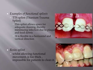  Examples of functional splints
 TTS splint (Titanium Trauma
Splint)
 This splint allows space for
adequate cleaning, thereby
minimizing infection due to plaque
and food debris
 It is flexible in a horizontal and
vertical direction
 Resin splint
 whilst allowing functional
movement, is too thick ,
impossible for patients to clean it.
 