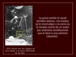La grave artritis le causó
                                      terribles dolores. Los huesos
                                    se le encorvaban y la carne se
                                     le secaba (sufría de un sudor
                                       por síndrome constitucional
                                       que le llevó a una extrema
                                                caquexia).



  1915. Renoir con sus zapatos de
lana debido a la grave deformidad
           de los pies.
 