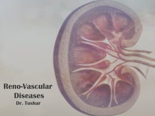 Reno-Vascular
Diseases
Dr. Tushar
 