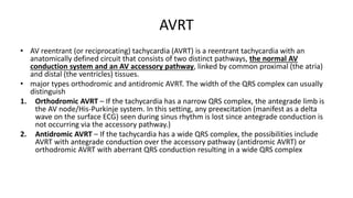 NARROW QRS TACHYCARDIA PART II | PPTX