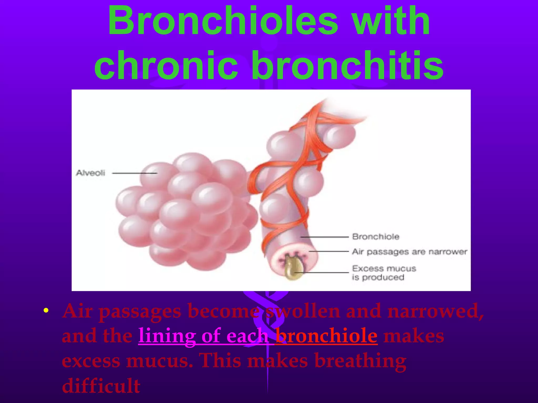 Air passages become swollen and narrowed, and the   lining of each  bronchiole   makes excess mucus. This makes breathing difficult   Bronchioles with chronic bronchitis 