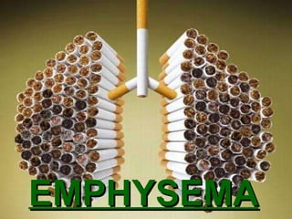 EMPHYSEMA 
