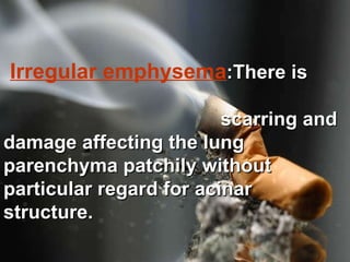 Irregular emphysema :There is  scarring and damage affecting the lung parenchyma patchily without particular regard for acinar structure.   