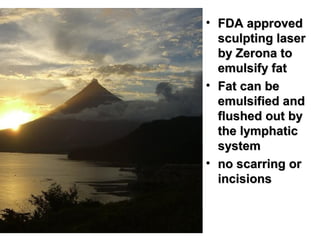 • FDA approved
  sculpting laser
  by Zerona to
  emulsify fat
• Fat can be
  emulsified and
  flushed out by
  the lymphatic
  system
• no scarring or
  incisions
 
