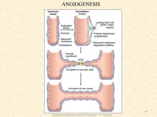 44
ROBBINS PATHOLOGIC BASICS OF DISEASE – 9TH EDITION
ANGIOGENESIS
 