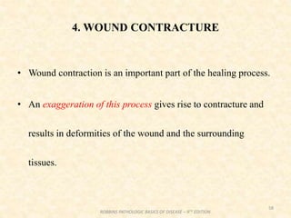4. WOUND CONTRACTURE
• Wound contraction is an important part of the healing process.
• An exaggeration of this process gives rise to contracture and
results in deformities of the wound and the surrounding
tissues.
58
ROBBINS PATHOLOGIC BASICS OF DISEASE – 9TH EDITION
 