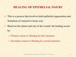 HEALING OF EPITHELIAL INJURY
• This is a process that involves both epithelial regeneration and
formation of connective tissue scar.
• Based on the nature and size of the wound the healing occurs
by:
– Primary union or Healing by first intention
– Secondary union or Healing by second intention
60
HARSH MOHAN TEXTBOOK OF PATHOLOGY – 7TH EDITION
 