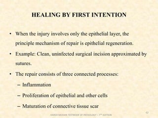 HEALING BY FIRST INTENTION
• When the injury involves only the epithelial layer, the
principle mechanism of repair is epithelial regeneration.
• Example: Clean, uninfected surgical incision approximated by
sutures.
• The repair consists of three connected processes:
– Inflammation
– Proliferation of epithelial and other cells
– Maturation of connective tissue scar
62
HARSH MOHAN TEXTBOOK OF PATHOLOGY – 7TH EDITION
 
