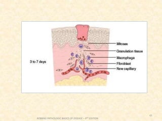 65
ROBBINS PATHOLOGIC BASICS OF DISEASE – 9TH EDITION
 