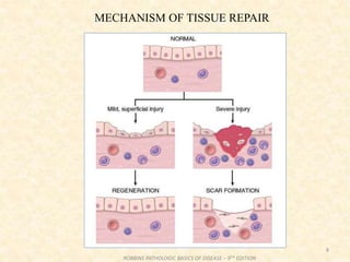 8
ROBBINS PATHOLOGIC BASICS OF DISEASE – 9TH EDITION
MECHANISM OF TISSUE REPAIR
 