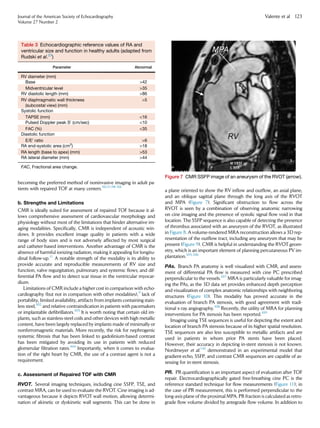 becoming the preferred method of noninvasive imaging in adult pa-
tients with repaired TOF at many centers.50,51,98-101
b. Strengths and Limitations
CMR is ideally suited for assessment of repaired TOF because it al-
lows comprehensive assessment of cardiovascular morphology and
physiology without most of the limitations that hinder alternative im-
aging modalities. Speciﬁcally, CMR is independent of acoustic win-
dows. It provides excellent image quality in patients with a wide
range of body sizes and is not adversely affected by most surgical
and catheter-based interventions. Another advantage of CMR is the
absence of harmful ionizing radiation, making it appealing for longitu-
dinal follow-up.11
A notable strength of the modality is its ability to
provide accurate and reproducible measurements of RV size and
function, valve regurgitation, pulmonary and systemic ﬂows, and dif-
ferential PA ﬂow and to detect scar tissue in the ventricular myocar-
dium.
Limitations of CMR include a higher cost in comparison with echo-
cardiography (but not in comparison with other modalities),9
lack of
portability, limited availability, artifacts from implants containing stain-
less steel,102
and relative contraindication in patients with pacemakers
or implantable deﬁbrillators.103
It is worth noting that certain old im-
plants, such as stainless-steel coils and other devices with high metallic
content, have been largely replaced by implants made of minimally or
nonferromagnetic materials. More recently, the risk for nephrogenic
systemic ﬁbrosis that has been linked to gadolinium-based contrast
has been mitigated by avoiding its use in patients with reduced
glomerular ﬁltration rates.104
Importantly, when it comes to evalua-
tion of the right heart by CMR, the use of a contrast agent is not a
requirement.
c. Assessment of Repaired TOF with CMR
RVOT. Several imaging techniques, including cine SSFP, TSE, and
contrast MRA, can be used to evaluate the RVOT. Cine imaging is ad-
vantageous because it depicts RVOT wall motion, allowing determi-
nation of akinetic or dyskinetic wall segments. This can be done in
a plane oriented to show the RV inﬂow and outﬂow, an axial plane,
and an oblique sagittal plane through the long axis of the RVOT
and MPA (Figure 7). Signiﬁcant obstruction to ﬂow across the
RVOT is seen by a combination of observing anatomic narrowing
on cine imaging and the presence of systolic signal ﬂow void in that
location. The SSFP sequence is also capable of detecting the presence
of thrombus associated with an aneurysm of the RVOT, as illustrated
in Figure 8. A volume-rendered MRA reconstruction allows a 3D rep-
resentation of the outﬂow tract, including any aneurysm that may be
present (Figure 9). CMR is helpful in understanding the RVOT geom-
etry, which is an important element of planning percutaneous PV im-
plantation.105,106
PAs. Branch PA anatomy is well visualized with CMR, and assess-
ment of differential PA ﬂow is measured with cine PC prescribed
perpendicular to the vessels.107
MRA is particularly valuable for imag-
ing the PAs, as the 3D data set provides enhanced depth perception
and visualization of complex anatomic relationships with neighboring
structures (Figure 10). This modality has proved accurate in the
evaluation of branch PA stenosis, with good agreement with tradi-
tional x-ray angiography.108
Recently, the utility of MRA for planning
interventions for PA stenosis has been reported.109
Imaging using TSE sequences is useful for depicting the extent and
location of branch PA stenosis because of its higher spatial resolution.
TSE sequences are also less susceptible to metallic artifacts and are
used in patients in whom prior PA stents have been placed.
However, their accuracy in depicting in-stent stenosis is not known.
Nordmeyer et al.110
demonstrated in an experimental model that
gradient-echo, SSFP, and contrast CMR sequences are capable of as-
sessing for in-stent stenosis.
PR. PR quantiﬁcation is an important aspect of evaluation after TOF
repair. Electrocardiographically gated free-breathing cine PC is the
reference standard technique for ﬂow measurements (Figure 11); in
the case of PR measurement, this is performed perpendicular to the
long-axis plane of the proximal MPA. PR fraction is calculated as retro-
grade ﬂow volume divided by antegrade ﬂow volume. In addition to
Figure 7 CMR SSFP image of an aneurysm of the RVOT (arrow).
Table 3 Echocardiographic reference values of RA and
ventricular size and function in healthy adults (adapted from
Rudski et al.23
)
Parameter Abnormal
RV diameter (mm)
Base 42
Midventricular level 35
RV diastolic length (mm) 86
RV diaphragmatic wall thickness
(subcostal view) (mm)
5
Systolic function
TAPSE (mm) 16
Pulsed Doppler peak S0
(cm/sec) 10
FAC (%) 35
Diastolic function
E/E0
ratio 6
RA end-systolic area (cm2
) 18
RA length (base to apex) (mm) 53
RA lateral diameter (mm) 44
FAC, Fractional area change.
Journal of the American Society of Echocardiography
Volume 27 Number 2
Valente et al 123
 