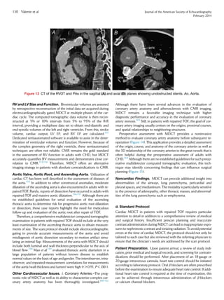 RV and LV Size and Function. Biventricular volumes are assessed
by retrospective reconstruction of the initial data set acquired during
electrocardiographically gated MDCT at multiple phases of the car-
diac cycle. The computed tomographic data volume is then recon-
structed at 5% or 10% intervals from 5% to 95% of the R-R
interval, providing a multiphase data set to obtain end-diastolic and
end-systolic volumes of the left and right ventricles. From this, stroke
volume, cardiac output, LV EF, and RV EF are calculated.152
Dedicated semiautomated software is available to assist in the deter-
mination of ventricular volumes and function. However, because of
the complex geometry of the right ventricle, these semiautomated
techniques are often not reliable. CMR remains the gold standard
in the assessment of RV function in adults with CHD, but MDCT
accurately quantiﬁes RV measurements and demonstrates close cor-
relation to CMR.153,154
Therefore, MDCT offers an alternative
imaging strategy in patients with absolute contraindications to CMR.
Aortic Valve, Aortic Root, and Ascending Aorta. Utilization of
cardiac CT has been well described in the assessment of diseases of
the aorta.155
In addition to other conotruncal anomalies, moderate
dilatation of the ascending aorta is also encountered in adults with re-
paired TOF. Rarely, reports of dissection have occurred in adults with
repaired TOF and massive aortic dilatation.156,157
Although there are
no established guidelines for serial evaluation of the ascending
thoracic aorta to determine risk for progressive aortic root dilatation
or dissection, these case reports highlight the need for meticulous
follow-up and evaluation of the aortic root after repair of TOF.
Therefore, a comprehensive multidetector computed tomographic
examination in patients with repaired TOF should include at the very
least examination of the ascending thoracic aorta to obtain measure-
ments of size. The scan protocol should include electrocardiographic
gating to provide accurate measurements of the aorta and avoid
misdiagnosis of aortic dissection secondary to motion artifact simu-
lating an intimal ﬂap. Measurements of the aorta with MDCT should
include both luminal and wall thickness perpendicular to the axis of
blood ﬂow.158
Mao et al.159
evaluated thoracic aortic diameters in a
large population of patients without known disease to establish
normal values on the basis of age and gender. The interobserver, intra-
observer, and repeated measurement correlations for measurements
of the aorta (wall thickness and lumen) were high (r  0.91, P  .001).
Other Cardiovascular Issues. i. Coronary Arteries.–The prog-
nostic role of MDCTas well as its ability to characterize complex cor-
onary artery anatomy has been thoroughly investigated.160-162
Although there have been several advances in the evaluation of
coronary artery anatomy and atherosclerosis with CMR imaging,
MDCT remains a favorable imaging technique with higher
diagnostic performance and accuracy in the evaluation of coronary
artery stenosis.163
Still, in patients with repaired TOF, the goal of cor-
onary artery imaging usually centers on the origins, proximal courses,
and spatial relationships to neighboring structures.
Preoperative assessment with MDCT provides a noninvasive
method to evaluate coronary artery anatomy before subsequent re-
operation (Figure 14). This application provides a detailed assessment
of the origin, course, and anatomy of the coronary arteries as well as
the 3D relationship of the coronary arteries to the great vessels that is
often helpful during the preoperative assessment of adults with
CHD.164
Although there are no established guidelines for such preop-
erative multidetector computed tomographic evaluation, this tech-
nique may identify concerning ﬁndings that can inﬂuence surgical
planning (Figure 15).
Noncardiac Findings. MDCT can provide additional insight into
abnormalities of the airways, lung parenchyma, pericardial and
pleural spaces, and mediastinum. The modality is particularly sensitive
to the presence of adenopathy, other thoracic masses, and abnormal-
ities of the lung parenchyma such as emphysema.
d. Standard Protocol
Cardiac MDCT in patients with repaired TOF requires particular
attention to detail in addition to a comprehensive review of medical
and surgical history. Insufﬁcient prescan planning and inaccurate
contrast administration during MDCT can lead to inappropriate expo-
sures to nephrotoxic contrast and ionizing radiation. To avoid potential
errors at the time of cardiac MDCT, the protocol should not only be
tailored to each case but also reviewed with the referring physician to
ensure that the clinician’s needs are addressed by the scan protocol.
Patient Preparation. Upon patient arrival, a review of study indi-
cation, prior medical and surgical records, and screening for contrain-
dications should be performed. After placement of an 18-gauge or
20-gauge intravenous cannula, heart rate control should be initiated
according to laboratory protocol. Oral b-blockers are often prescribed
before the examination to ensure adequate heart rate control. If addi-
tional heart rate control is required at the time of examination, this
can be achieved through intravenous administration of b-blockers
or calcium channel blockers.
Figure 13 CT of the RVOT and PAs in the sagittal (A) and axial (B) planes showing unobstructed stents. Ao, Aorta.
130 Valente et al Journal of the American Society of Echocardiography
February 2014
 