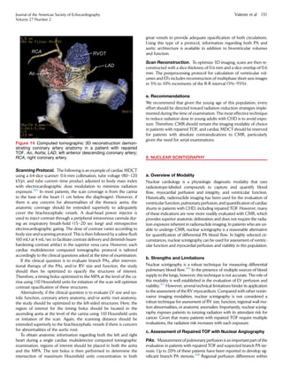 Scanning Protocol. The following is an example of cardiac MDCT
using a 64-slice scanner: 0.6-mm collimation, tube voltage (80–120
kVp), and tube current–time product adjusted to body mass index
with electrocardiographic dose modulation to minimize radiation
exposure.165
In most patients, the scan coverage is from the carina
to the base of the heart (1 cm below the diaphragm). However, if
there is any concern for abnormalities of the thoracic aorta, the
anatomic coverage should be extended superiorly to adequately
cover the brachiocephalic vessels. A dual-head power injector is
used to inject contrast through a peripheral intravenous cannula dur-
ing an inspiratory breath-hold (15–20 sec long) and retrospective
electrocardiographic gating. The dose of contrast varies according to
body size and scanning protocol. This is then followed by a saline ﬂush
(60 mL) at 4 mL/sec to facilitate contrast delivery and diminish beam-
hardening contrast artifact in the superior vena cava. However, each
cardiac multidetector computed tomographic protocol is tailored
accordingly to the clinical questions asked at the time of examination.
If the clinical question is to evaluate branch PAs, after interven-
tional therapy of the PAs, and/or RV size and function, the study
should then be optimized to opacify the structures of interest.
Therefore, a timing bolus optimized to the MPA at the level of the ca-
rina using 110 Hounsﬁeld units for initiation of the scan will optimize
contrast opaciﬁcation of these structures.
Alternatively, if the clinical question is to evaluate LV size and sys-
tolic function, coronary artery anatomy, and/or aortic root anatomy,
the study should be optimized to the left-sided structures. Here, the
region of interest for the timing bolus should be located in the
ascending aorta at the level of the carina using 110 Hounsﬁeld units
or initiation of the scan. Again, the scanning distance should be
extended superiorly to the brachiocephalic vessels if there is concern
for abnormalities of the aortic root.
To obtain anatomic information regarding both the left and right
heart during a single cardiac multidetector computed tomographic
examination, regions of interest should be placed in both the aorta
and the MPA. The test bolus is then performed to determine the
intersection of maximum Hounsﬁeld units concentration in both
great vessels to provide adequate opaciﬁcation of both circulations.
Using this type of a protocol, information regarding both PA and
aortic architecture is available in addition to biventricular volumes
and function.
Scan Reconstruction. To optimize 3D imaging, scans are then re-
constructed with a slice thickness of 0.6 mm and a slice overlap of 0.6
mm. The postprocessing protocol for calculation of ventricular vol-
umes and EFs includes reconstruction of multiphase short-axis images
in 5% to 10% increments of the R-R interval (5%–95%).
e. Recommendations
We recommend that given the young age of this population, every
effort should be directed toward radiation reduction strategies imple-
mented during the time of examination. The most effective technique
to reduce radiation dose in young adults with CHD is to avoid expo-
sure. Therefore, CMR should remain the imaging modality of choice
in patients with repaired TOF, and cardiac MDCTshould be reserved
for patients with absolute contraindications to CMR, particularly
given the need for serial examinations.
8. NUCLEAR SCINTIGRAPHY
a. Overview of Modality
Nuclear cardiology is a physiologic diagnostic modality that uses
radioisotope-labeled compounds to capture and quantify blood
ﬂow, myocardial perfusion and integrity, and ventricular function.
Historically, radionuclide imaging has been used for the evaluation of
ventricular function, pulmonary perfusion,and quantiﬁcation of cardiac
shunts in patients with CHD, including repaired TOF. However, many
of these indications are now more readily evaluated with CMR, which
provides superior anatomic delineation and does not require the radia-
tion exposure inherent in radionuclide imaging. In patients who are un-
able to undergo CMR, nuclear scintigraphy is a reasonable alternative
for quantiﬁcation of differential PA blood ﬂow. In highly selected cir-
cumstances, nuclear scintigraphy can be used for assessment of ventric-
ular function and myocardial perfusion and viability in this population.
b. Strengths and Limitations
Nuclear scintigraphy is a robust technique for measuring differential
pulmonary blood ﬂow.166
In the presence of multiple sources of blood
supply to the lungs, however, this technique is not accurate. The role of
this modality is well established in the evaluation of LV perfusion and
viability.167
However, several technical limitations hinder its application
to the assessment of the RV myocardium. Compared with other nonin-
vasive imaging modalities, nuclear scintigraphy is not considered a
robust technique for assessment of RV size, function, regional wall mo-
tion abnormalities, or anatomic anomalies. Importantly, nuclear scintig-
raphy exposes patients to ionizing radiation with its attendant risk for
cancer. Given that many patients with repaired TOF require multiple
evaluations, the radiation risk increases with each exposure.
c. Assessment of Repaired TOF with Nuclear Angiography
PAs. Measurement of pulmonary perfusion is an important part of the
evaluation in patients with repaired TOF and suspected branch PA ste-
nosis. Up to 20% of these patients have been reported to develop sig-
niﬁcant branch PA stenosis.168
Regional perfusion differences within
Figure 14 Computed tomographic 3D reconstruction demon-
strating coronary artery anatomy in a patient with repaired
TOF. Ao, Aorta; LAD, left anterior descending coronary artery;
RCA, right coronary artery.
Journal of the American Society of Echocardiography
Volume 27 Number 2
Valente et al 131
 