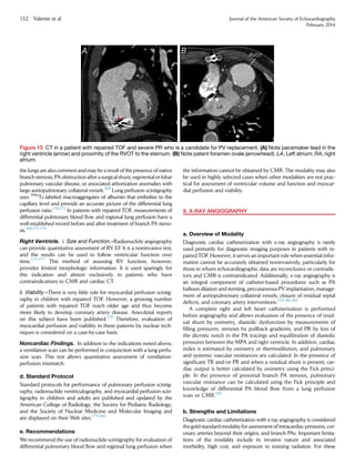 the lungs are also common and may be a result of the presence of native
branch stenosis, PA obstruction after a surgical shunt, segmental or lobar
pulmonary vascular disease, or associated arborization anomalies with
large aortopulmonary collateral vessels.169
Lung perfusion scintigraphy
uses 99m
Tc-labeled macroaggregates of albumin that embolize to the
capillary level and provide an accurate picture of the differential lung
perfusion ratio.170,171
In patients with repaired TOF, measurements of
differential pulmonary blood ﬂow and regional lung perfusion have a
well-established record before and after treatment of branch PA steno-
sis.166,171-174
Right Ventricle. i. Size and Function.–Radionuclide angiography
can provide quantitative assessment of RV EF. It is a noninvasive test,
and the results can be used to follow ventricular function over
time.175-177
This method of assessing RV function, however,
provides limited morphologic information. It is used sparingly for
this indication and almost exclusively in patients who have
contraindications to CMR and cardiac CT.
ii. Viability.–There is very little role for myocardial perfusion scintig-
raphy in children with repaired TOF. However, a growing number
of patients with repaired TOF reach older age and thus become
more likely to develop coronary artery disease. Anecdotal reports
on this subject have been published.178
Therefore, evaluation of
myocardial perfusion and viability in these patients by nuclear tech-
niques is considered on a case-by-case basis.
Noncardiac Findings. In addition to the indications noted above,
a ventilation scan can be performed in conjunction with a lung perfu-
sion scan. This test allows quantitative assessment of ventilation-
perfusion mismatch.
d. Standard Protocol
Standard protocols for performance of pulmonary perfusion scintig-
raphy, radionuclide ventriculography, and myocardial perfusion scin-
tigraphy in children and adults are published and updated by the
American College of Radiology, the Society for Pediatric Radiology,
and the Society of Nuclear Medicine and Molecular Imaging and
are displayed on their Web sites.179,180
e. Recommendations
We recommend the use of radionuclide scintigraphy for evaluation of
differential pulmonary blood ﬂow and regional lung perfusion when
the information cannot be obtained by CMR. The modality may also
be used in highly selected cases when other modalities are not prac-
tical for assessment of ventricular volume and function and myocar-
dial perfusion and viability.
9. X-RAY ANGIOGRAPHY
a. Overview of Modality
Diagnostic cardiac catheterization with x-ray angiography is rarely
used primarily for diagnostic imaging purposes in patients with re-
paired TOF. However, it serves an important role when essential infor-
mation cannot be accurately obtained noninvasively, particularly for
those in whom echocardiographic data are inconclusive or contradic-
tory and CMR is contraindicated. Additionally, x-ray angiography is
an integral component of catheter-based procedures such as PA
balloon dilation and stenting, percutaneous PV implantation, manage-
ment of aortopulmonary collateral vessels, closure of residual septal
defects, and coronary artery interventions.133,181,182
A complete right and left heart catheterization is performed
before angiography and allows evaluation of the presence of resid-
ual shunt by oximetry, diastolic dysfunction by measurements of
ﬁlling pressures, stenosis by pullback gradients, and PR by loss of
the dicrotic notch in the PA tracings and equilibration of diastolic
pressures between the MPA and right ventricle. In addition, cardiac
index is estimated by oximetry or thermodilution, and pulmonary
and systemic vascular resistances are calculated. In the presence of
signiﬁcant TR and/or PR and when a residual shunt is present, car-
diac output is better calculated by oximetry using the Fick princi-
ple. In the presence of proximal branch PA stenosis, pulmonary
vascular resistance can be calculated using the Fick principle and
knowledge of differential PA blood ﬂow from a lung perfusion
scan or CMR.183
b. Strengths and Limitations
Diagnostic cardiac catheterization with x-ray angiography is considered
thegold-standard modality for assessment of intracardiac pressures, cor-
onary arteries beyond their origins, and branch PAs. Important limita-
tions of the modality include its invasive nature and associated
morbidity, high cost, and exposure to ionizing radiation. For these
Figure 15 CT in a patient with repaired TOF and severe PR who is a candidate for PV replacement. (A) Note pacemaker lead in the
right ventricle (arrow) and proximity of the RVOT to the sternum. (B) Note patent foramen ovale (arrowhead). LA, Left atrium; RA, right
atrium.
132 Valente et al Journal of the American Society of Echocardiography
February 2014
 